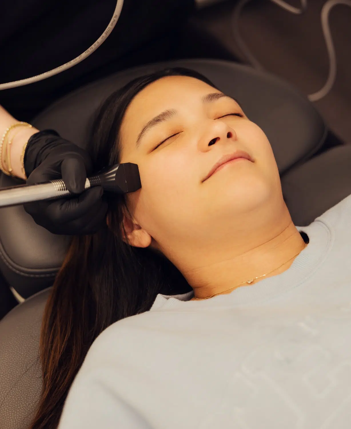 woman receiving forma skin tightening at bcrn