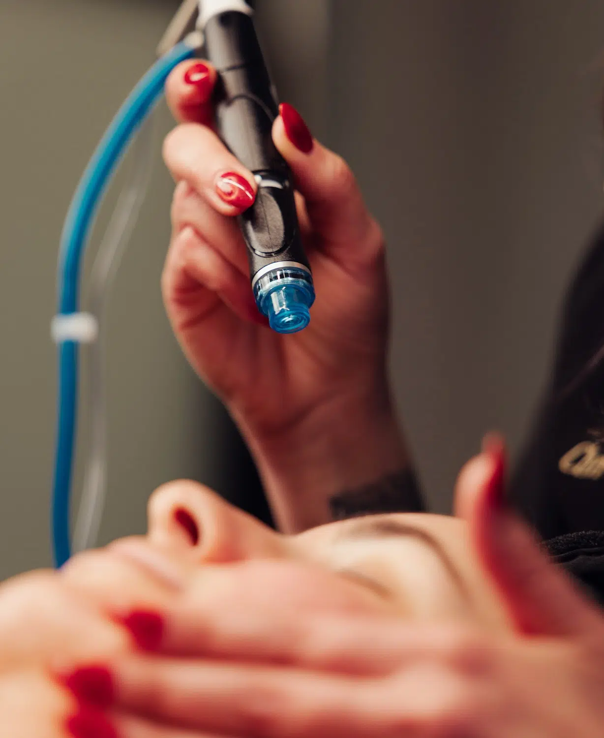 woman receiving hydrafacial treatment at bcrn