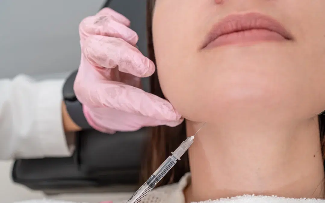How Much Time Is There Between Kybella Treatments?
